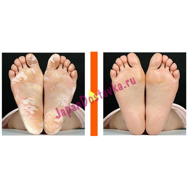 Японские носочки для педикюра (женские) Lovely Foot, MARNA (27 см)