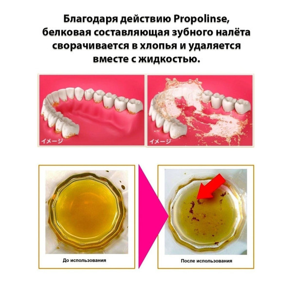 Ополаскиватель для полости рта, для очищения и отбеливания зубной эмали Propolinse Dental Whitening, Pieras 600 мл